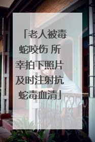 老人被毒蛇咬伤 所幸拍下照片及时注射抗蛇毒血清